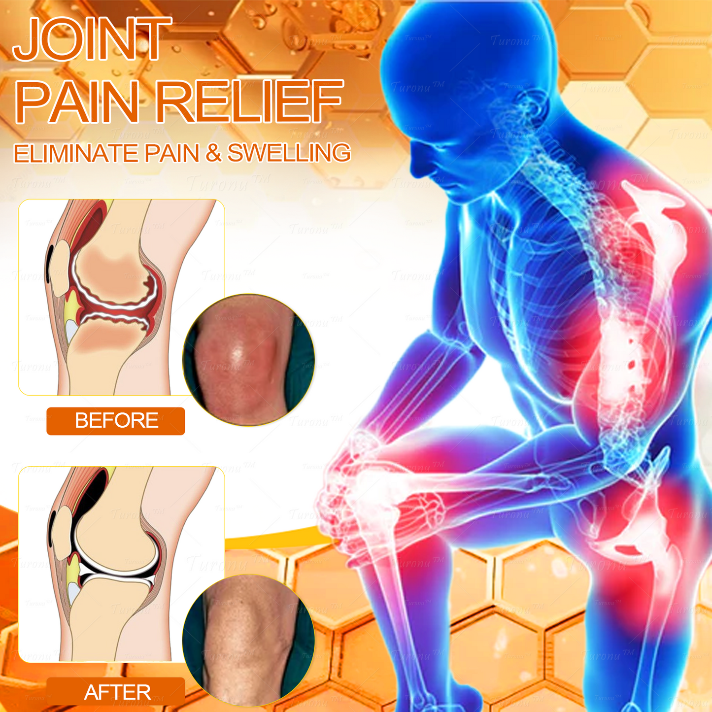 β
Official Store: Bee-Venom Pain-Relief Bone Healing Creamβ
( BOA Approved)(π₯π³πππ π
ππ πππππππππ 80% πππ)π