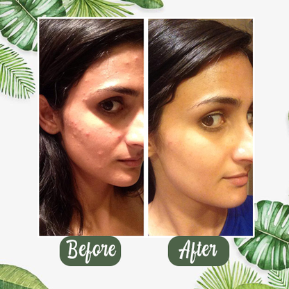 NEGUSY™  Green Tea Deep Cleanse Mask Stick