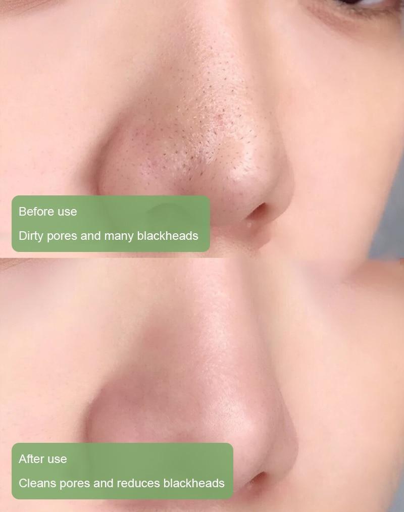 NEGUSY™  Green Tea Deep Cleanse Mask Stick