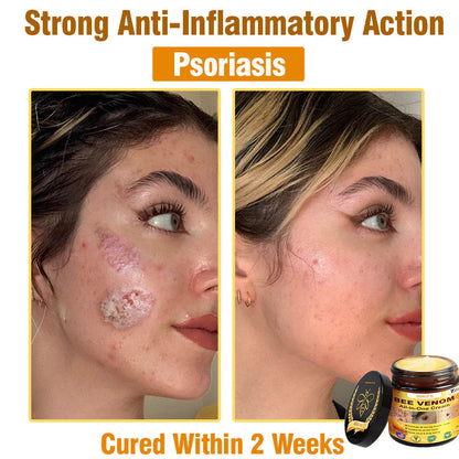 ODALIT™ Bee Poison All-in-One Cream US Dermatologist Approved