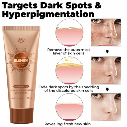 🔥Buy 2 Get 2 Free!-Herbal Spots Peel-Off Facial Mask