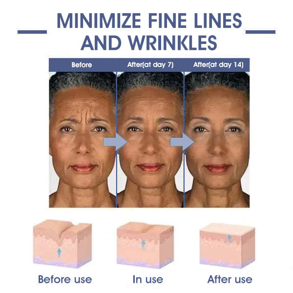 JEREMYTIS™ 𝐀𝐝𝐯𝐚𝐧𝐜𝐞𝐝 𝐅𝐢𝐫𝐦𝐢𝐧𝐠 & 𝐖𝐫𝐢𝐧𝐤𝐥𝐞-𝐑𝐞𝐝𝐮𝐜𝐢𝐧𝐠 𝐂𝐫𝐞𝐚𝐦: Restore Skin Elasticity