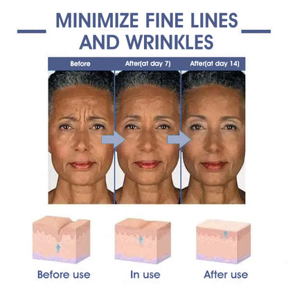 JEREMYTIS™ 𝐀𝐝𝐯𝐚𝐧𝐜𝐞𝐝 𝐅𝐢𝐫𝐦𝐢𝐧𝐠 & 𝐖𝐫𝐢𝐧𝐤𝐥𝐞-𝐑𝐞𝐝𝐮𝐜𝐢𝐧𝐠 𝐂𝐫𝐞𝐚𝐦: Restore Skin Elasticity