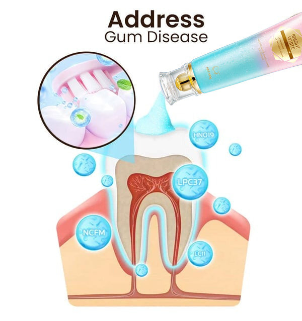 1🔥[Official Brand Store] ODALIT™ Niacinamide Intensive Whitening Toothpaste