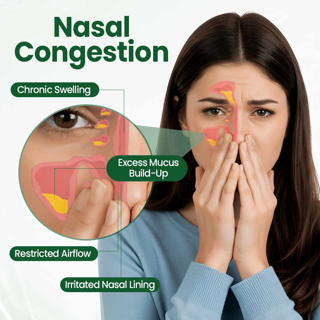 NEGUSY® RhiniThera Nasal Spray
