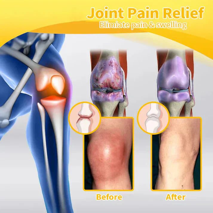🎁✅Official Store BUY 2 GET 1 FREE: flysmus™ Lidocaine Scar-Free Pain Relief Healing Liquid
