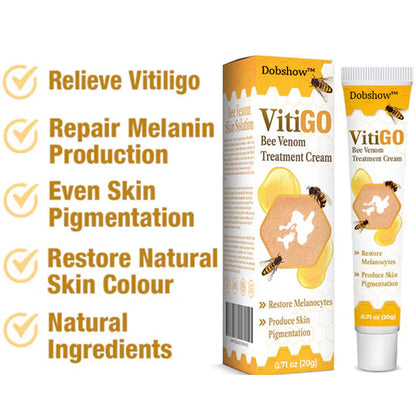【Official Flagship Store】 Bee Venom Vitiligo Treatment Cream