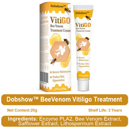 【Official Flagship Store】 Bee Venom Vitiligo Treatment Cream