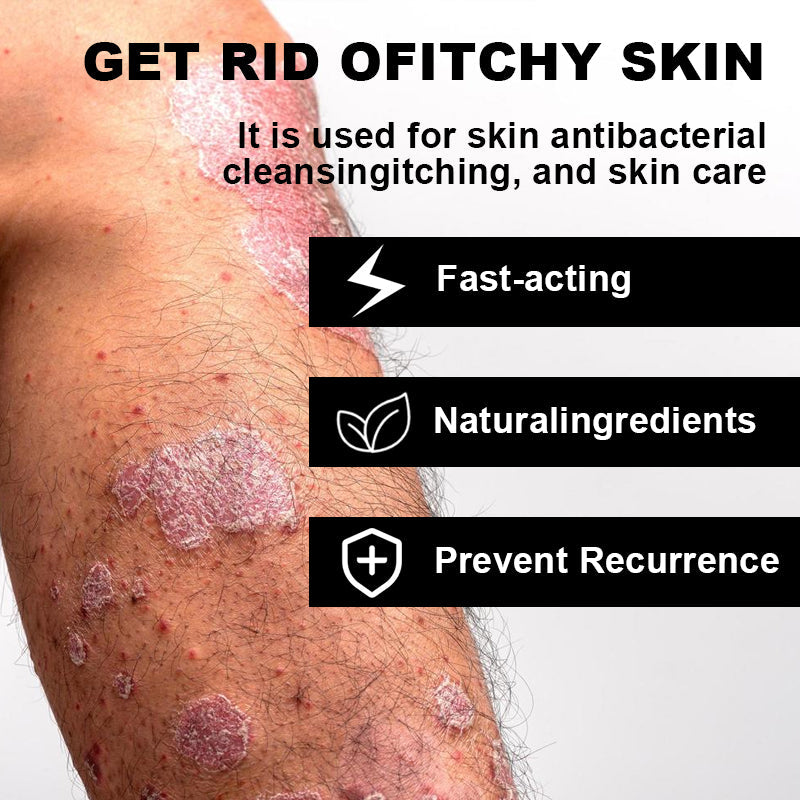 Psoriasis Cure Cream, relieves itching and restores smooth and youthful skin