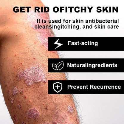 Psoriasis Cure Cream, relieves itching and restores smooth and youthful skin
