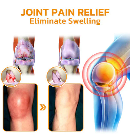 ✨[Official Brand Store] Bee poison Pain Relief and Bone Care Ointment