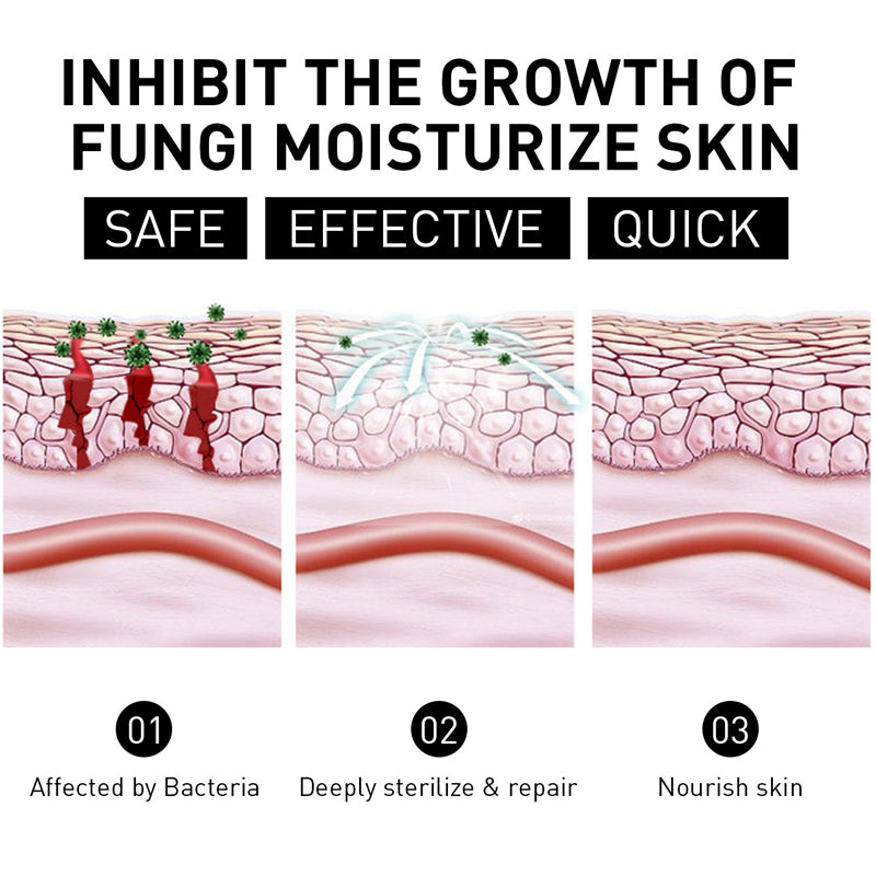 Psoriasis Cure Cream, relieves itching and restores smooth and youthful skin