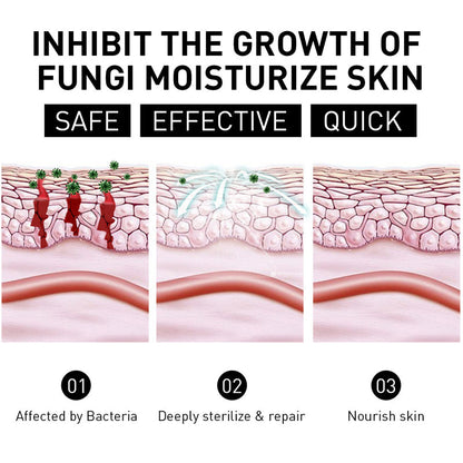 Psoriasis Cure Cream, relieves itching and restores smooth and youthful skin