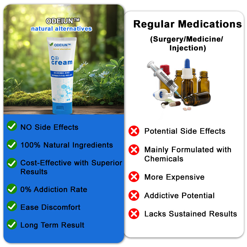 ✅NHS Approved: ODEIUN™ Skin Treatment Cream(Relieves eczema, dermatitis, psoriasis, skin allergies,  pigmentation, dry skin, and other common skin issues)