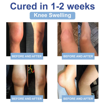 ✅NHS Approved: JEREMYTIS™ Magnesium Pain Healing Bone Cream  (Relief of neuropathy, muscle spasms, cramps or twitches, poor bone health and other arthritis)