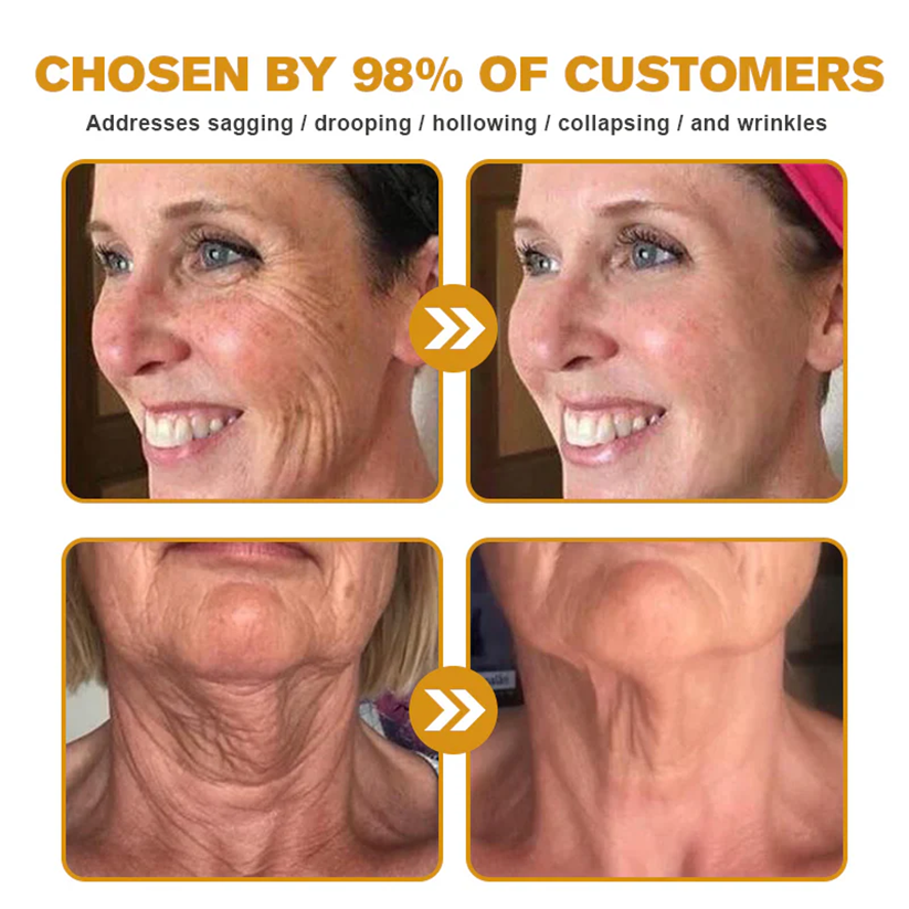 FDA Approved: ODALIT® Bee Venom Skin Restoration Cream — 🔥Limited Time 70% OFF🔥