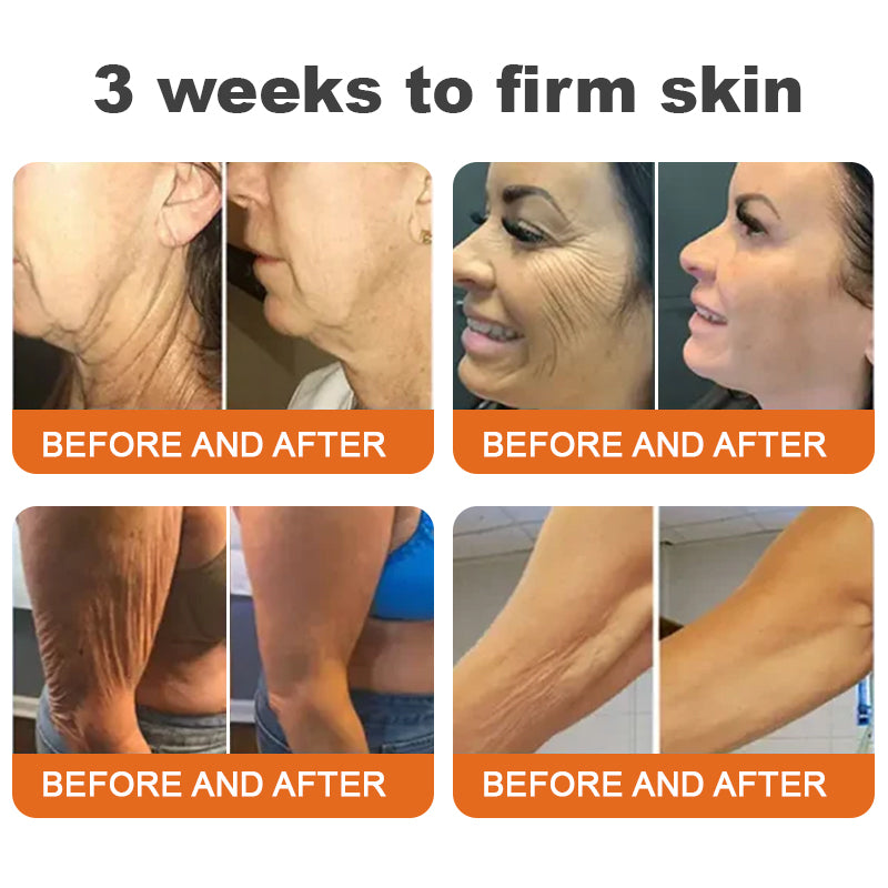 🍈Flysmus™ Botox Bee Venom Firming Serum Stick LAST DAY 60% OFF