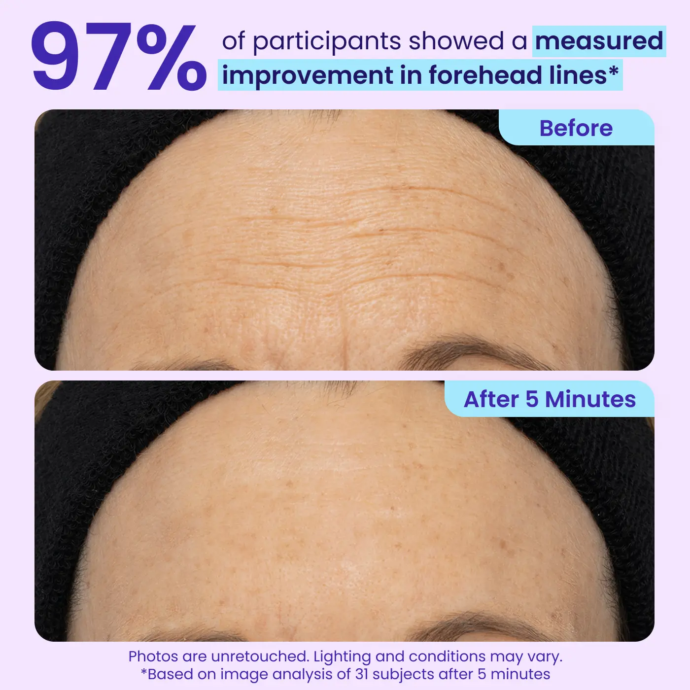 NEW! Instant Lift Eye Gel — Reduce the Look of Eye Bags in Minutes