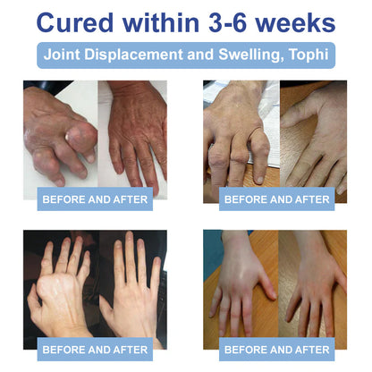 ✅NHS Approved: JEREMYTIS™ Magnesium Pain Healing Bone Cream  (Relief of neuropathy, muscle spasms, cramps or twitches, poor bone health and other arthritis)