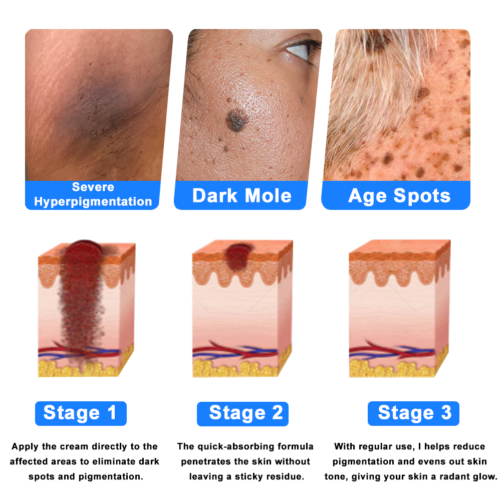 ✅NHS Approved: ODEIUN™ Skin Treatment Cream(Relieves eczema, dermatitis, psoriasis, skin allergies,  pigmentation, dry skin, and other common skin issues)