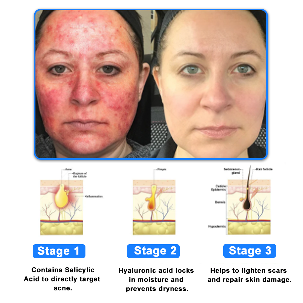 ✅NHS Approved: ODEIUN™ Skin Treatment Cream(Relieves eczema, dermatitis, psoriasis, skin allergies,  pigmentation, dry skin, and other common skin issues)
