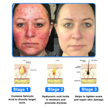 ✅NHS Approved: ODEIUN™ Skin Treatment Cream(Relieves eczema, dermatitis, psoriasis, skin allergies,  pigmentation, dry skin, and other common skin issues)