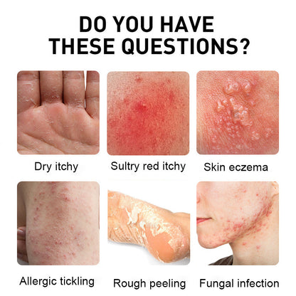 Psoriasis Cure Cream, relieves itching and restores smooth and youthful skin
