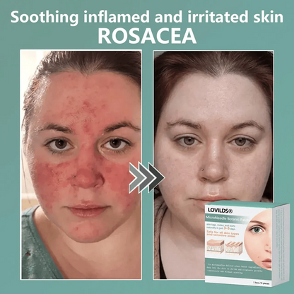🔥Final 3 Hours -  Magnesium MicroNeedle Quick Remove Skin Tag Patches