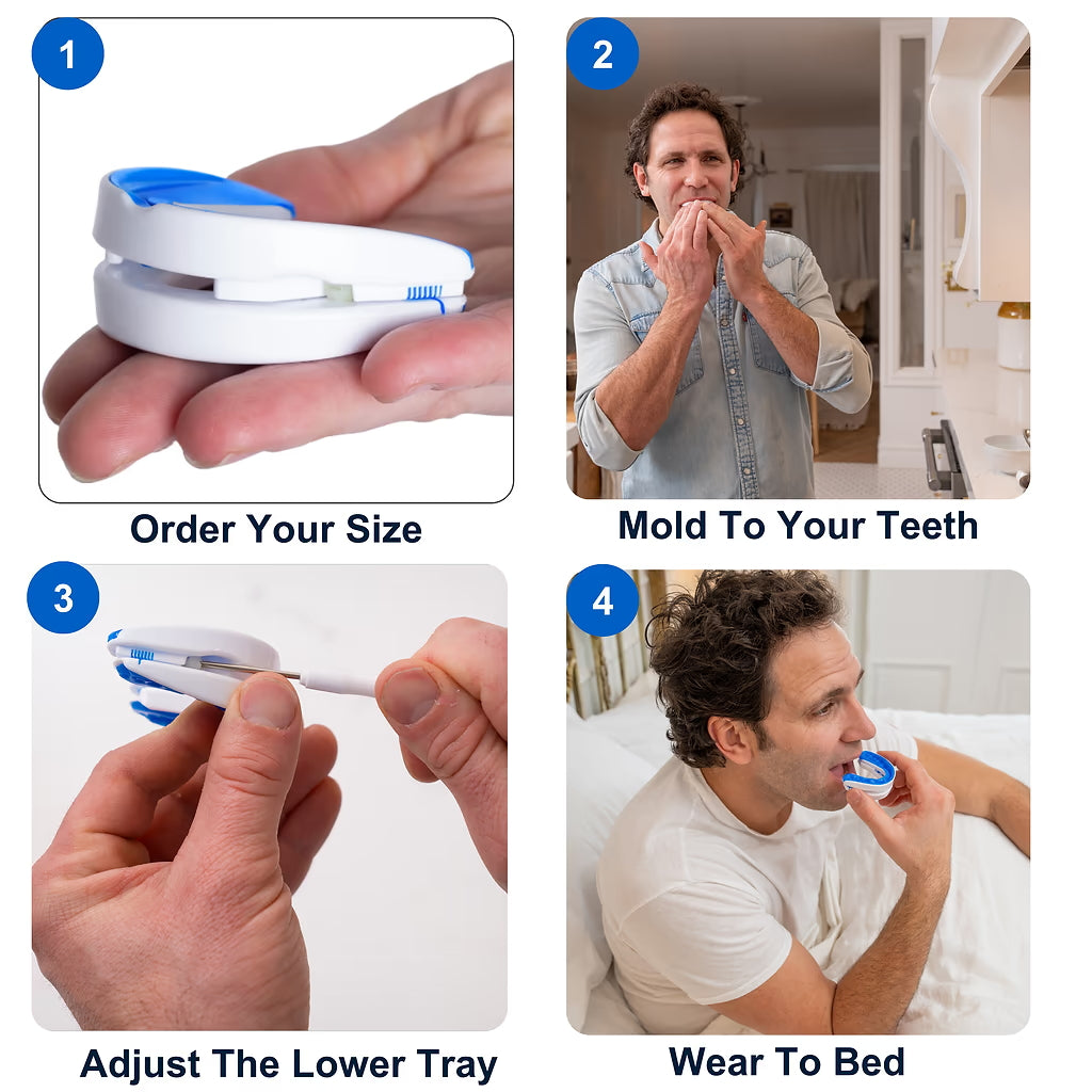 VitalSleep Anti-Snoring Mouthpiece