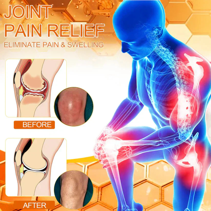 ✨[Official Brand Store] Bee poison Pain Relief and Bone Care Ointment