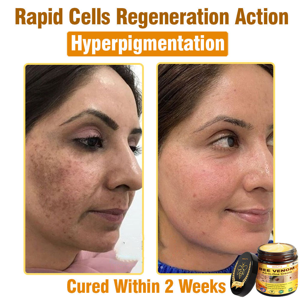 ODALIT™ Bee Poison All-in-One Cream US Dermatologist Approved