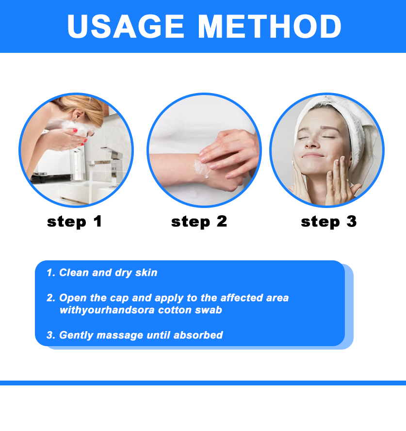 ✅NHS Approved: ODEIUN™ Skin Treatment Cream(Relieves eczema, dermatitis, psoriasis, skin allergies,  pigmentation, dry skin, and other common skin issues)