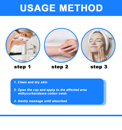 ✅NHS Approved: ODEIUN™ Skin Treatment Cream(Relieves eczema, dermatitis, psoriasis, skin allergies,  pigmentation, dry skin, and other common skin issues)