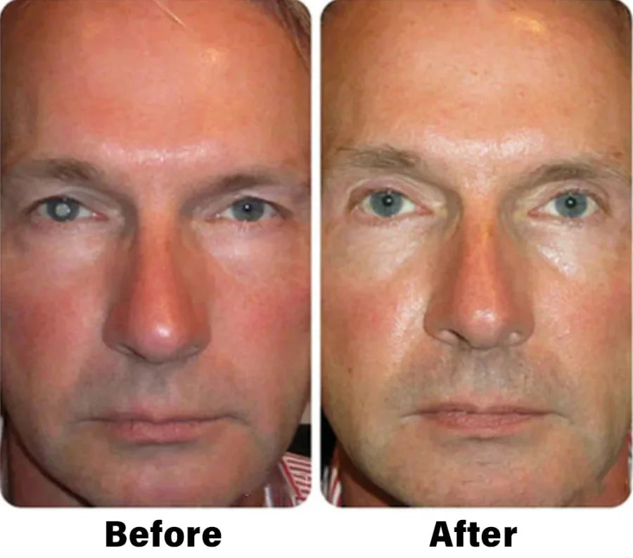 Nano Vision Repair Eye Serum ✅FDA Approved(Suitable for presbyopia, dry eye syndrome, glaucoma, and cataracts)
