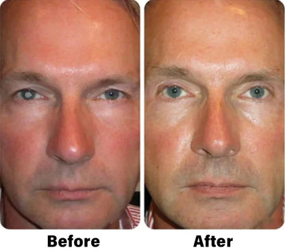 Nano Vision Repair Eye Serum ✅FDA Approved(Suitable for presbyopia, dry eye syndrome, glaucoma, and cataracts)