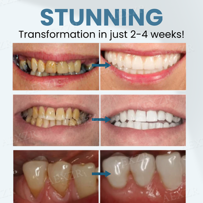 JEREMYTIS™ Bee Venom Teeth Restoration Powder