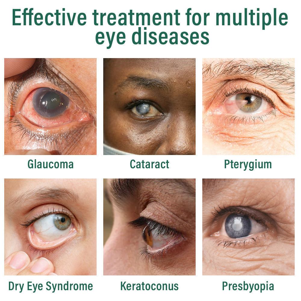 Nano Eye Drops Serum (Suitable for presbyopia, dry eye syndrome, glaucoma, and cataracts) 👀