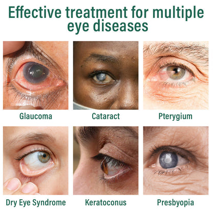 Nano Eye Drops Serum (Suitable for presbyopia, dry eye syndrome, glaucoma, and cataracts) 👀