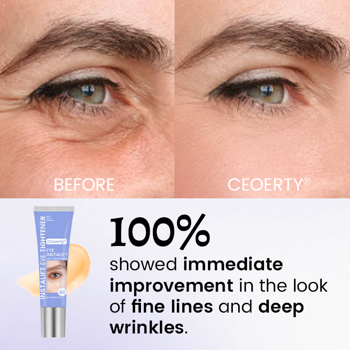 Eye Tightener – 10 Seconds to Younger, Fresher Eyes