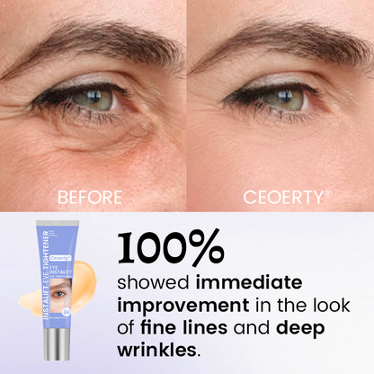 Eye Tightener – 10 Seconds to Younger, Fresher Eyes