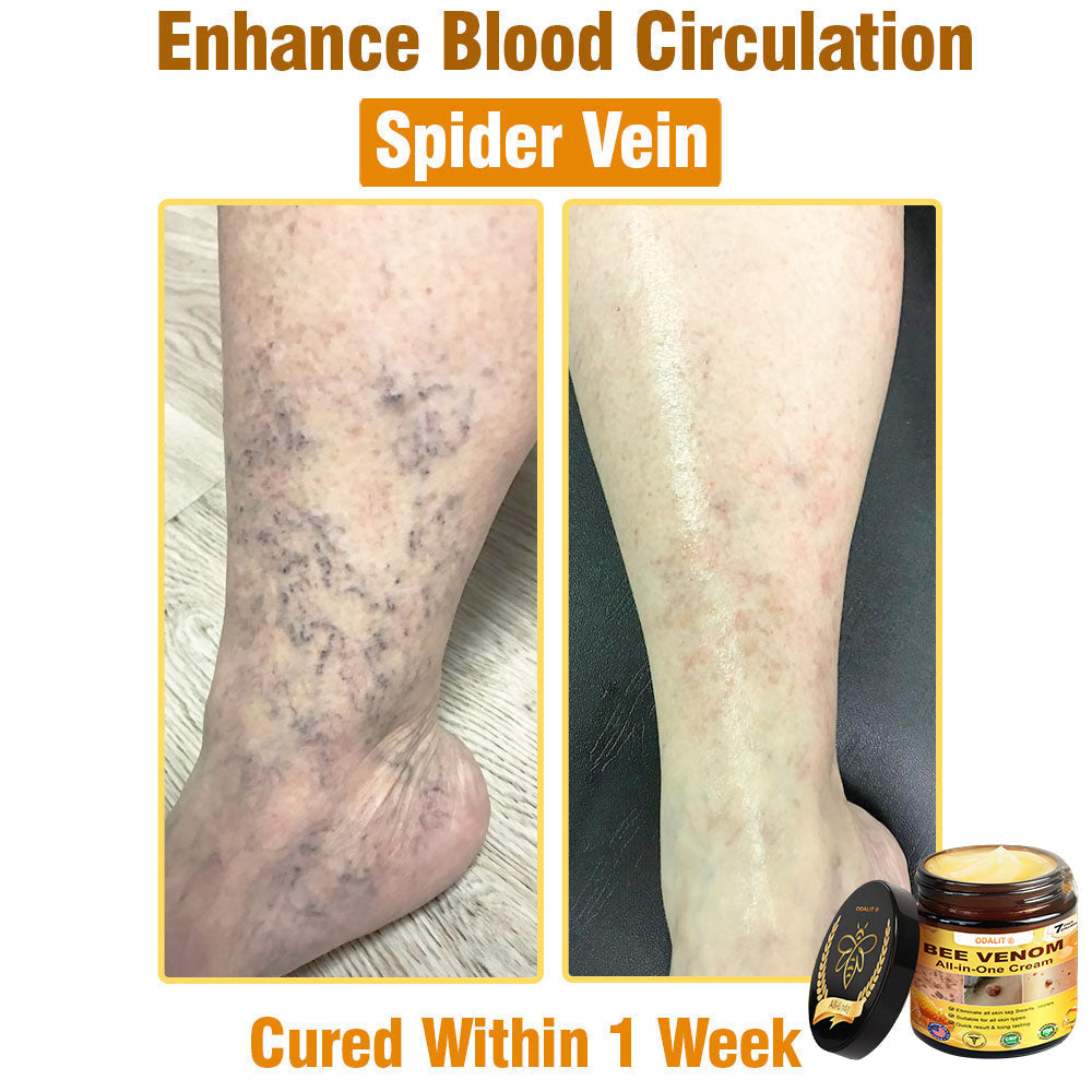 ODALIT™ Bee Poison All-in-One Cream US Dermatologist Approved