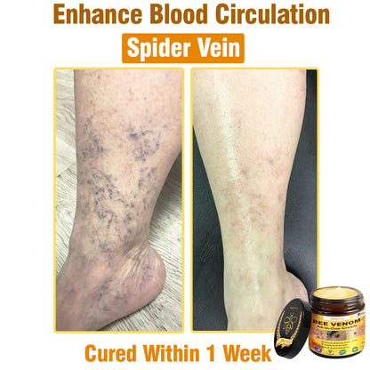 ODALIT™ Bee Poison All-in-One Cream US Dermatologist Approved
