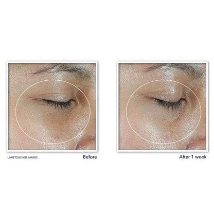 Revive + Glow Eye Balm with Vitamin C brightens and reduces puffiness ✨Buy 3 Free Shipping Only Today