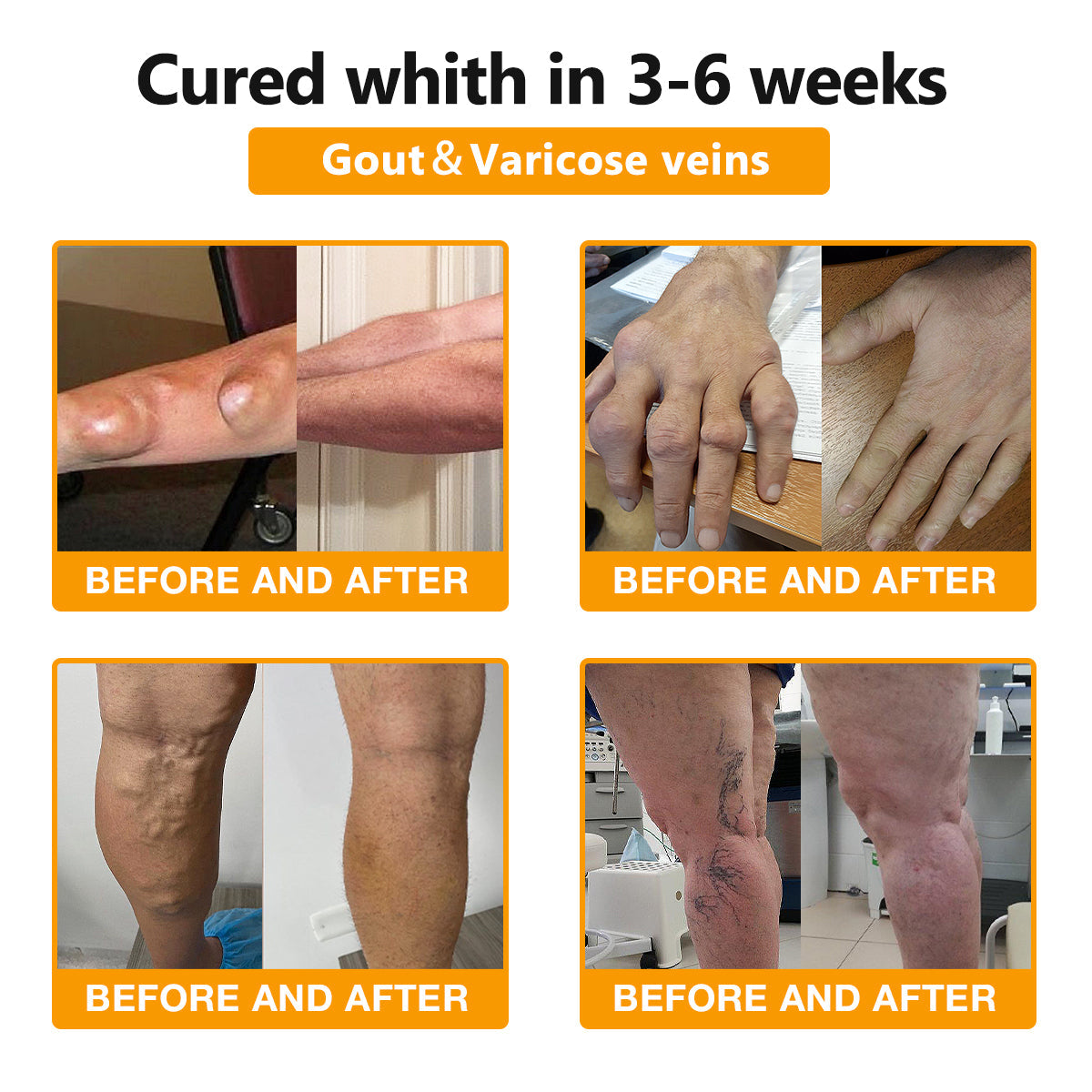 JEREMYTIS™ Bee-Venom Pain-Relief Bone Healing Cream🐝(Specially forolder adults & AAOS recommends)🔥