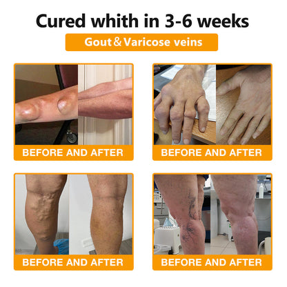 JEREMYTIS™ Bee-Venom Pain-Relief Bone Healing Cream🐝(Specially forolder adults & AAOS recommends)🔥