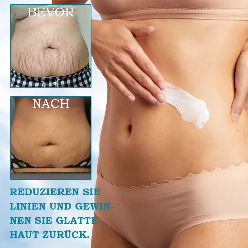 JEREMYTIS™ 𝐀𝐝𝐯𝐚𝐧𝐜𝐞𝐝 𝐅𝐢𝐫𝐦𝐢𝐧𝐠 & 𝐖𝐫𝐢𝐧𝐤𝐥𝐞-𝐑𝐞𝐝𝐮𝐜𝐢𝐧𝐠 𝐂𝐫𝐞𝐚𝐦: Restore Skin Elasticity
