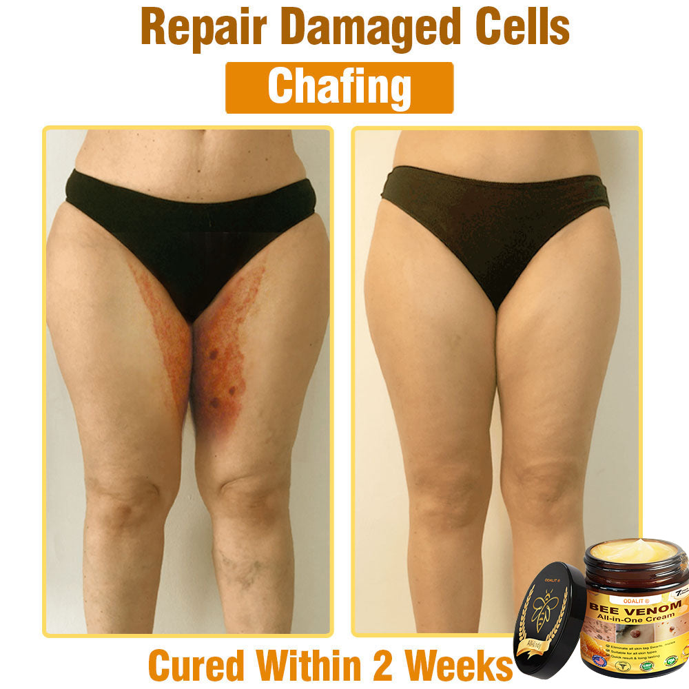 ODALIT™ Bee Poison All-in-One Cream US Dermatologist Approved