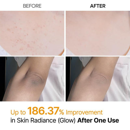 🌟Peel Shot Keratin Care Kojic Acid Turmeric Spray