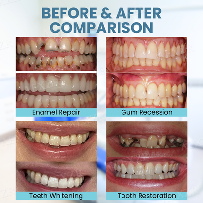 JEREMYTIS™ Bee Venom Teeth Restoration Powder