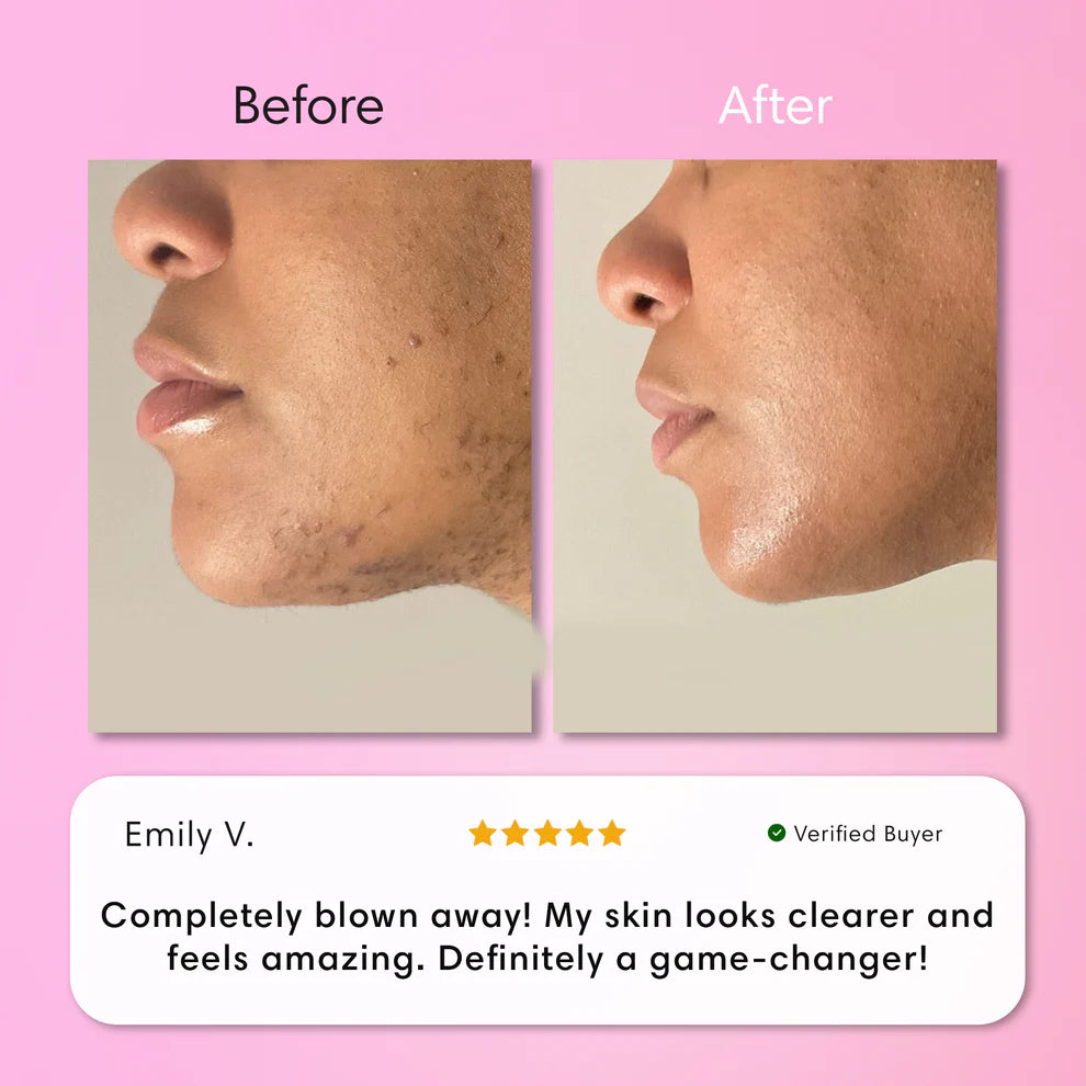 JEREMYTIS™ Instant Hair Removal Kit